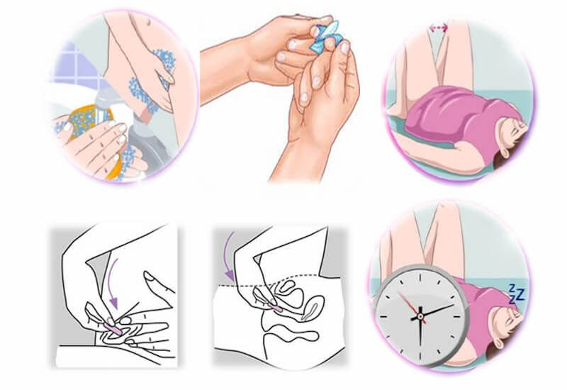 huong-dan-su-dung-vien-dat-phu-khoa-2