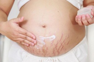 Massage bụng sau sinh có giảm rạn da không? [Chia sẻ từ chuyên gia]