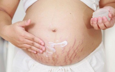 Massage bụng sau sinh có giảm rạn da không? [Chia sẻ từ chuyên gia]