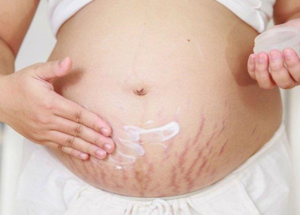 Massage bụng sau sinh có giảm rạn da không? [Chia sẻ từ chuyên gia]