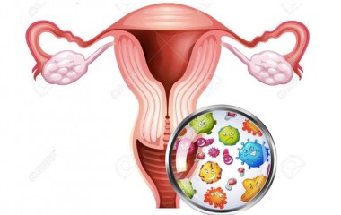 Tỉ lệ mắc bệnh viêm nhiễm phụ khoa mùa đông – xuân tăng