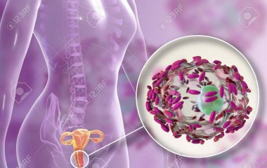 Nguyên nhân của nhiễm khuẩn âm đạo