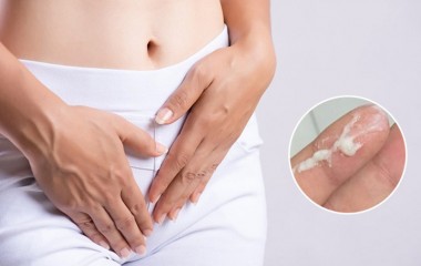 Khí hư khi mang thai là gì? Nguyên nhân, biểu hiện và cách khắc phục