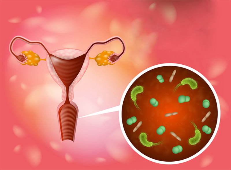 cach-phong-tranh-viem-phu-khoa-sau-sinh-1.